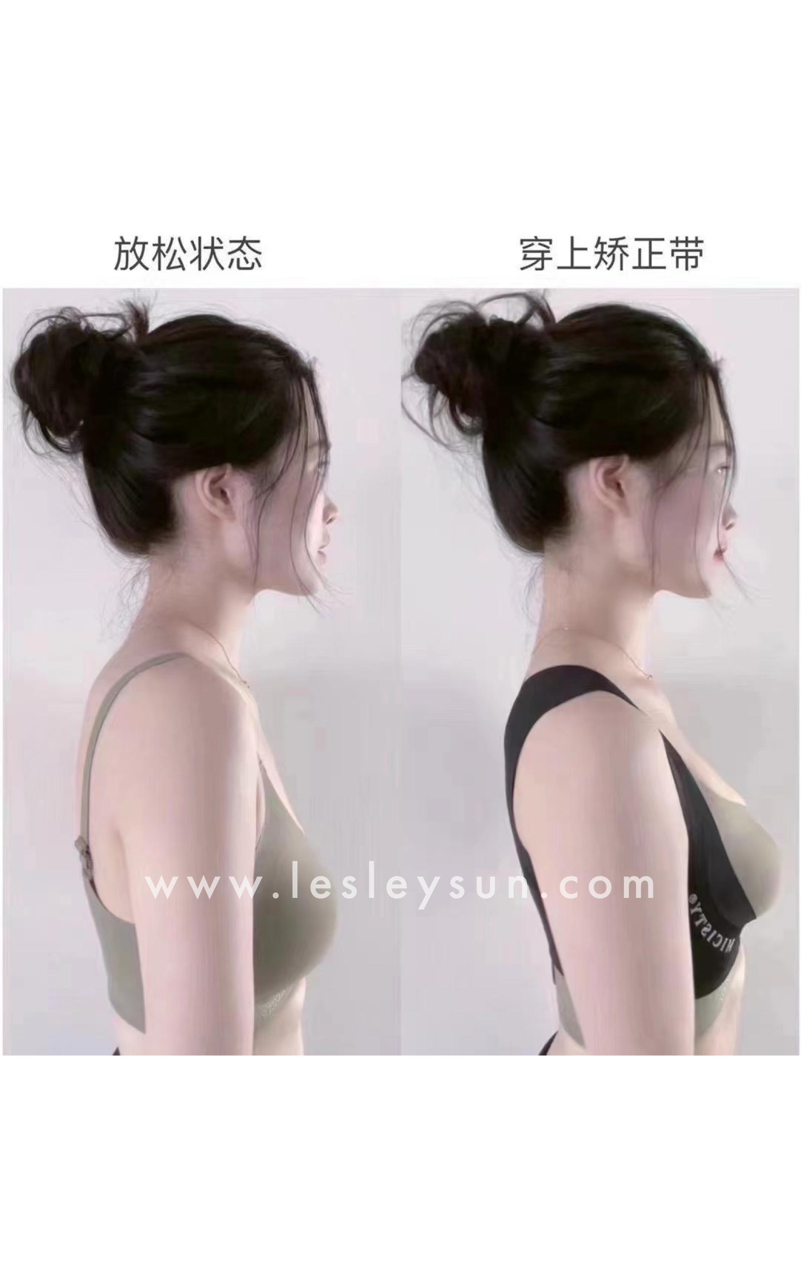 Authentic Micisty Back Support Strap [Due to hygiene concerns, no exchange is permissible]